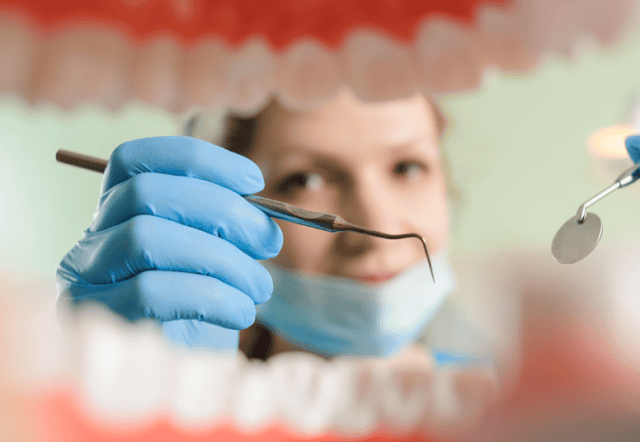 Oral Acrylic: A Wonder Product