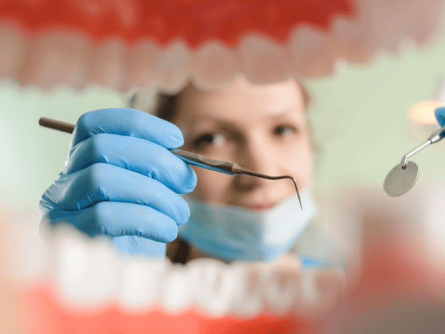 Oral Acrylic: A Wonder Product
